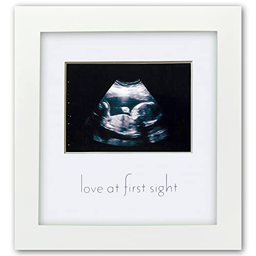 Sonogram Picture Frame - White Wooden Baby Ultrasound Photo Frame, Cute Nursery Decor, Pregnancy Gift and Keepsake for Expecting Moms